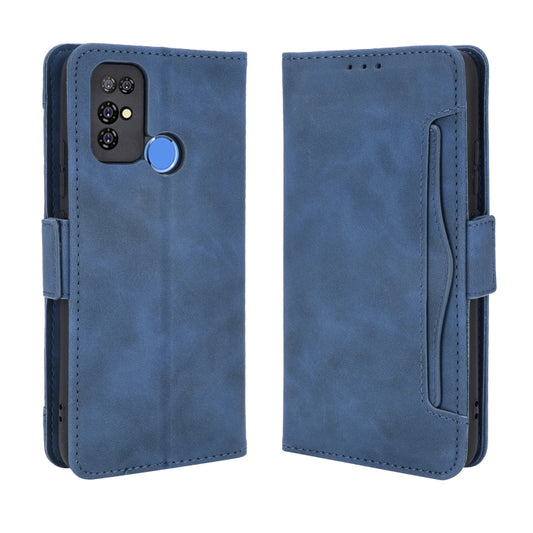 For Doogee X96 Pro Skin Feel Calf Pattern Horizontal Flip Leather Case with Holder & Card Slots & Photo Frame(Blue) by buy2fix