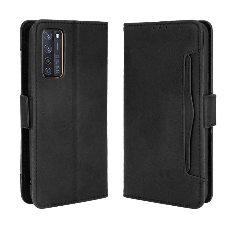 For ZTE Axon 20 5G / Axon 20 4G Wallet Style Skin Feel Calf Pattern Leather Case with Separate Card Slots(Black) - ZTE Cases by buy2fix | Online Shopping UK | buy2fix