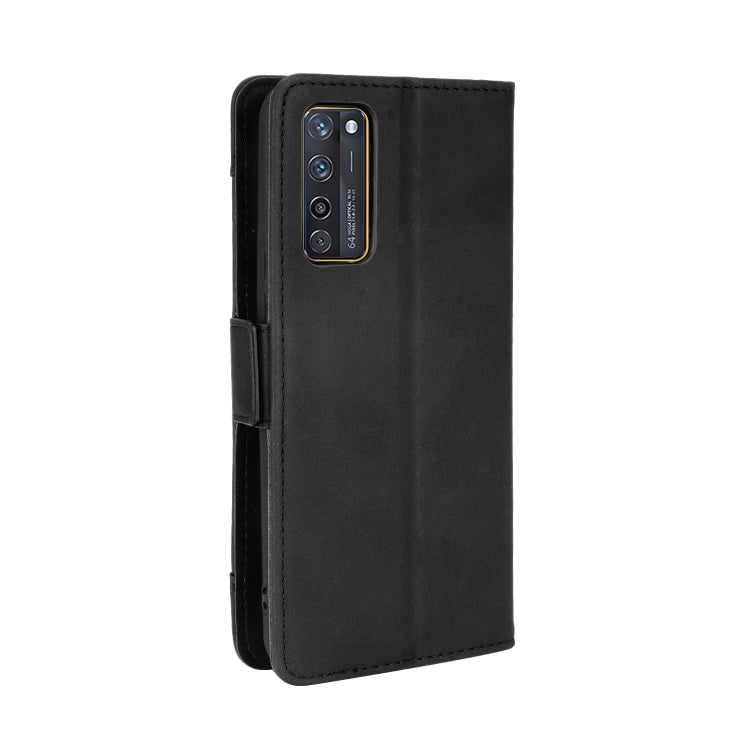 For ZTE Axon 20 5G / Axon 20 4G Wallet Style Skin Feel Calf Pattern Leather Case with Separate Card Slots(Black) - ZTE Cases by buy2fix | Online Shopping UK | buy2fix