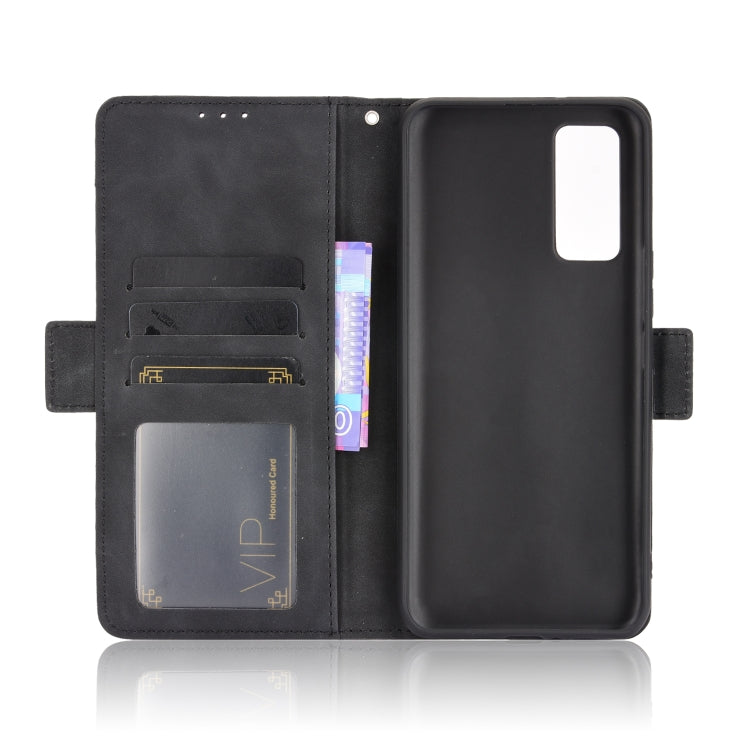 For ZTE Axon 20 5G / Axon 20 4G Wallet Style Skin Feel Calf Pattern Leather Case with Separate Card Slots(Black) - ZTE Cases by buy2fix | Online Shopping UK | buy2fix
