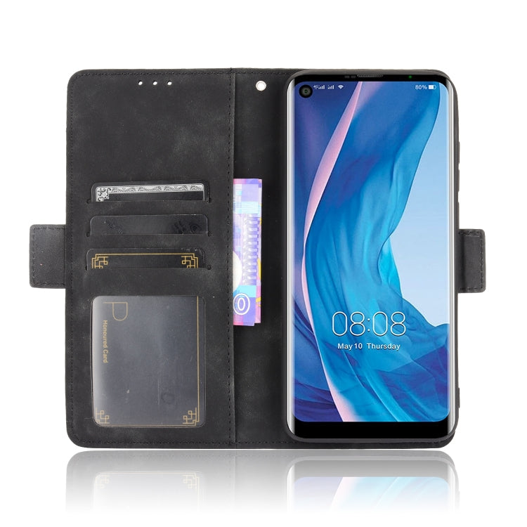 For Ulefone Note 11P Skin Feel Calf Pattern Horizontal Flip Leather Case with Holder & Card Slots & Photo Frame(Black) - Ulefone Cases by buy2fix | Online Shopping UK | buy2fix
