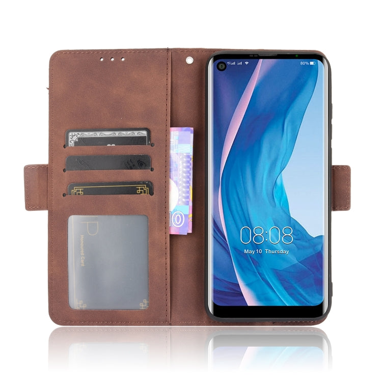 For Ulefone Note 11P Skin Feel Calf Pattern Horizontal Flip Leather Case with Holder & Card Slots & Photo Frame(Brown) - Ulefone Cases by buy2fix | Online Shopping UK | buy2fix