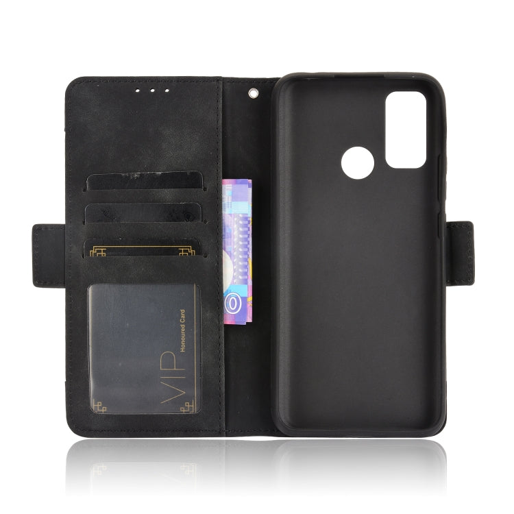 For Ulefone Note 10 Skin Feel Calf Pattern Horizontal Flip Leather Case with Holder & Card Slots & Photo Frame(Black) - Ulefone Cases by buy2fix | Online Shopping UK | buy2fix