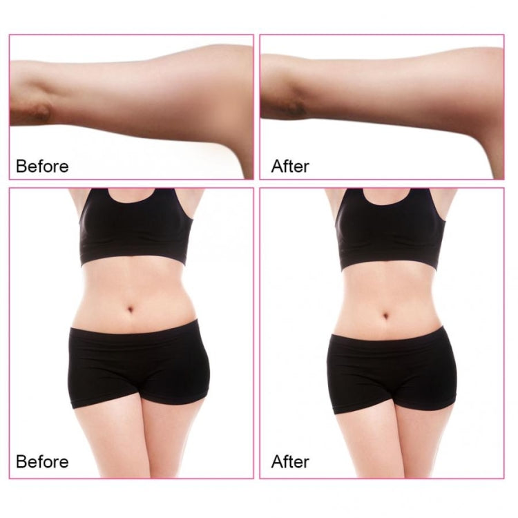 4 In 1 40K Ultrasonic Fat Blasting Device Radio Frequency Beauty Device Metal Handle US Plug - Beauty Instrument by buy2fix | Online Shopping UK | buy2fix
