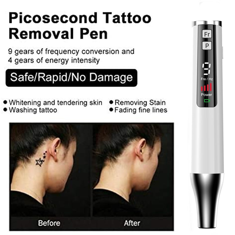 AA-A401 Small Freckle and Mole Removal Pen Tattoo and Eyebrow Removal Beauty Instrument, Color: Blu-ray Battery - Beauty Instrument by buy2fix | Online Shopping UK | buy2fix