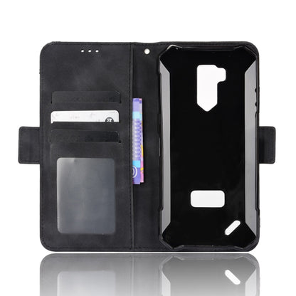 For Ulefone Armor X9 Skin Feel Calf Pattern Leather Phone Case(Black) by buy2fix