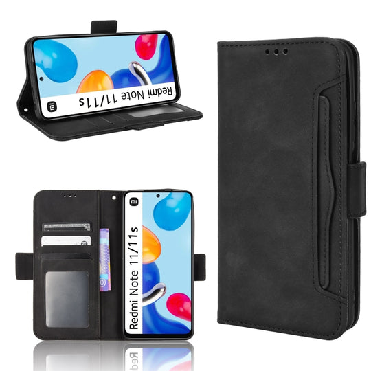 For Xiaomi Redmi Note 11S / Note 11 4G Overseas Version Skin Feel Calf Pattern Leather Phone Case(Black)