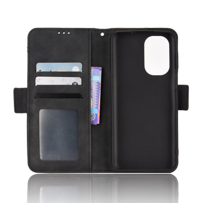 For Ulefone Note 13P Skin Feel Calf Pattern Leather Phone Case(Black) by buy2fix