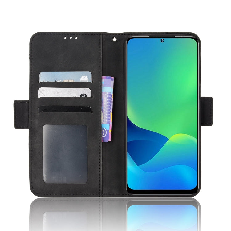 For Ulefone Note 13P Skin Feel Calf Pattern Leather Phone Case(Black) by buy2fix