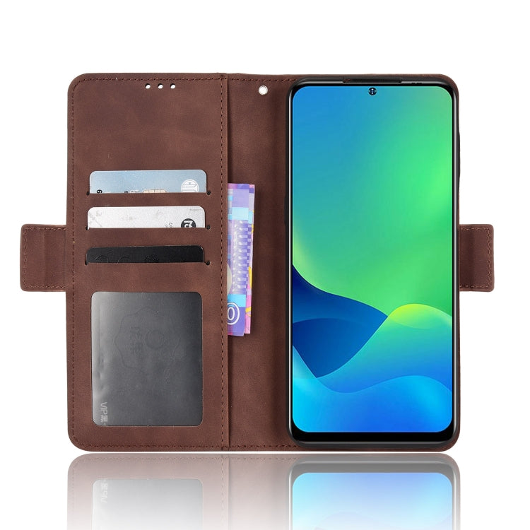 For Ulefone Note 13P Skin Feel Calf Pattern Leather Phone Case(Brown) by buy2fix