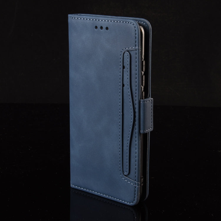 For Sony Xperia 10 VI 2024 Skin Feel Calf Texture Card Slots Leather Phone Case(Blue) by buy2fix