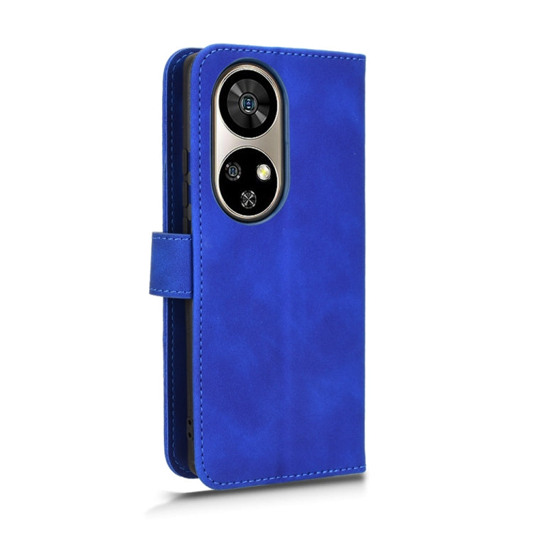 For Ulefone Note 17 Pro Skin Feel Magnetic Flip Leather Phone Case(Blue) by buy2fix