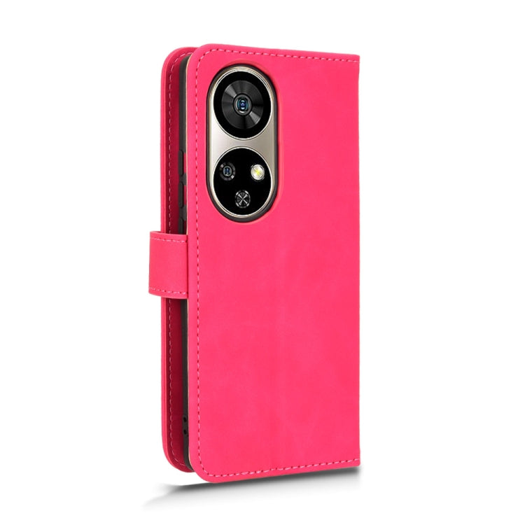 For Ulefone Note 17 Pro Skin Feel Magnetic Flip Leather Phone Case(Rose Red) by buy2fix
