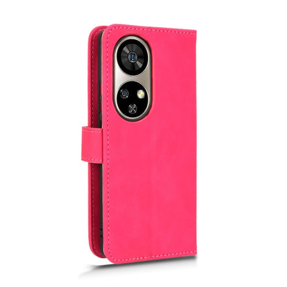 For Ulefone Note 17 Pro Skin Feel Magnetic Flip Leather Phone Case(Rose Red) by buy2fix