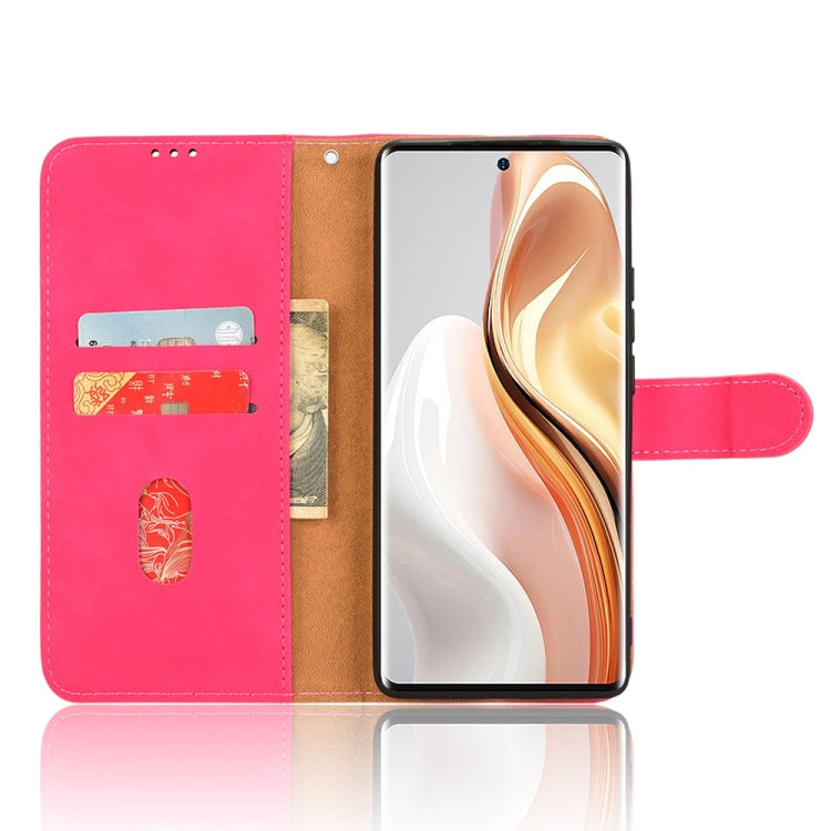 For Ulefone Note 17 Pro Skin Feel Magnetic Flip Leather Phone Case(Rose Red) by buy2fix