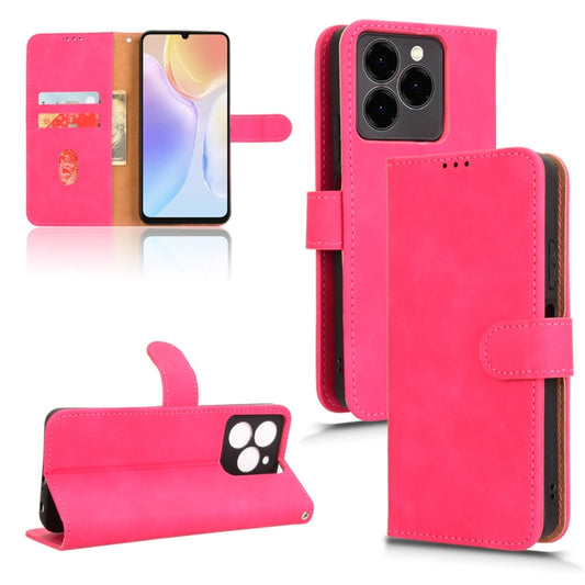 For Ulefone Note 20 Pro Skin Feel Magnetic Flip Leather Phone Case(Rose Red) by buy2fix