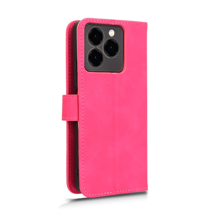 For Ulefone Note 20 Pro Skin Feel Magnetic Flip Leather Phone Case(Rose Red) by buy2fix