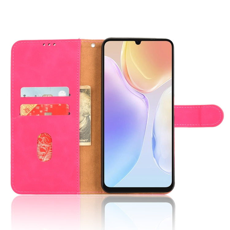 For Ulefone Note 20 Pro Skin Feel Magnetic Flip Leather Phone Case(Rose Red) by buy2fix