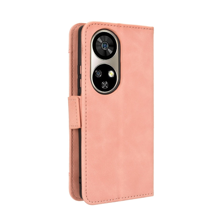 For Ulefone Note 17 Pro Skin Feel Calf Texture Card Slots Leather Phone Case(Pink) by buy2fix