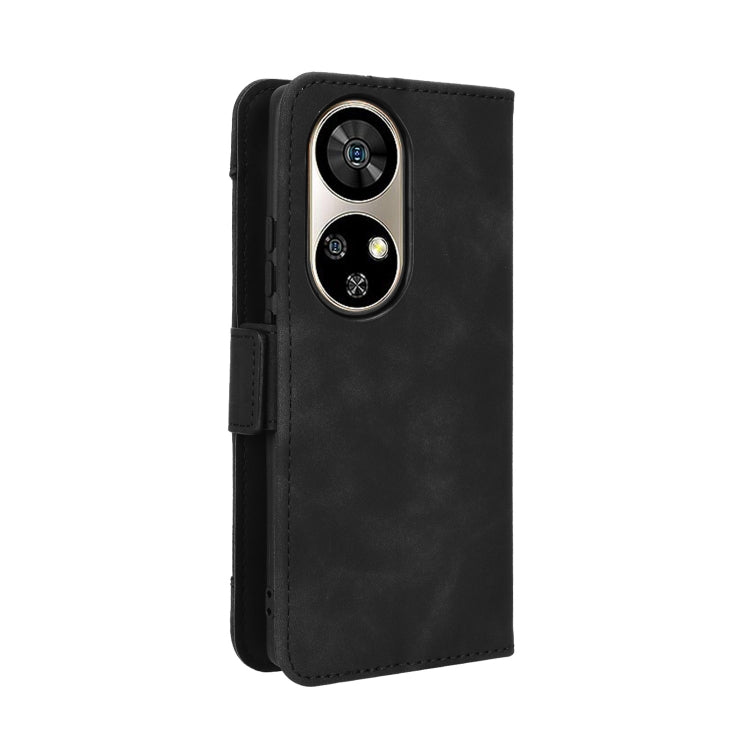 For Ulefone Note 17 Pro Skin Feel Calf Texture Card Slots Leather Phone Case(Black) by buy2fix