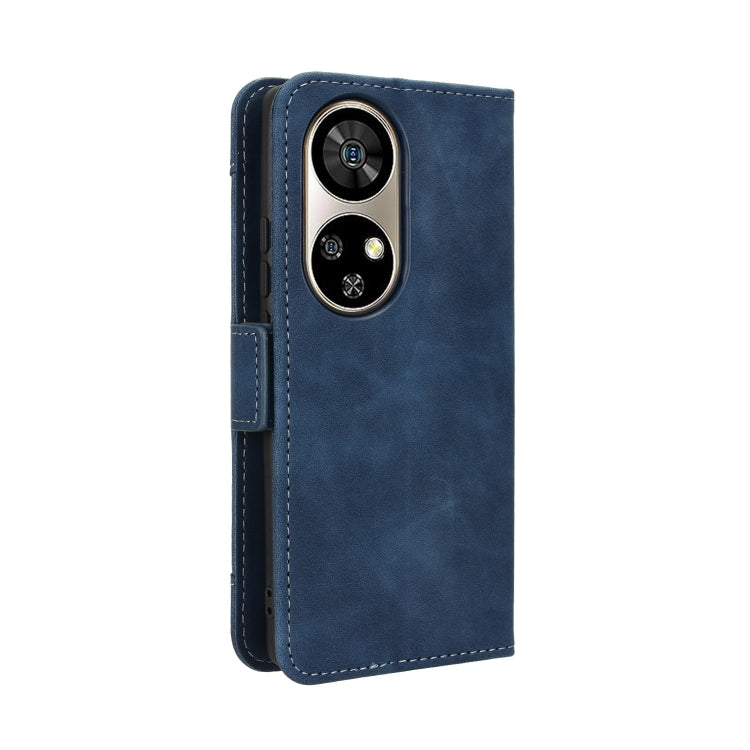 For Ulefone Note 17 Pro Skin Feel Calf Texture Card Slots Leather Phone Case(Blue) by buy2fix