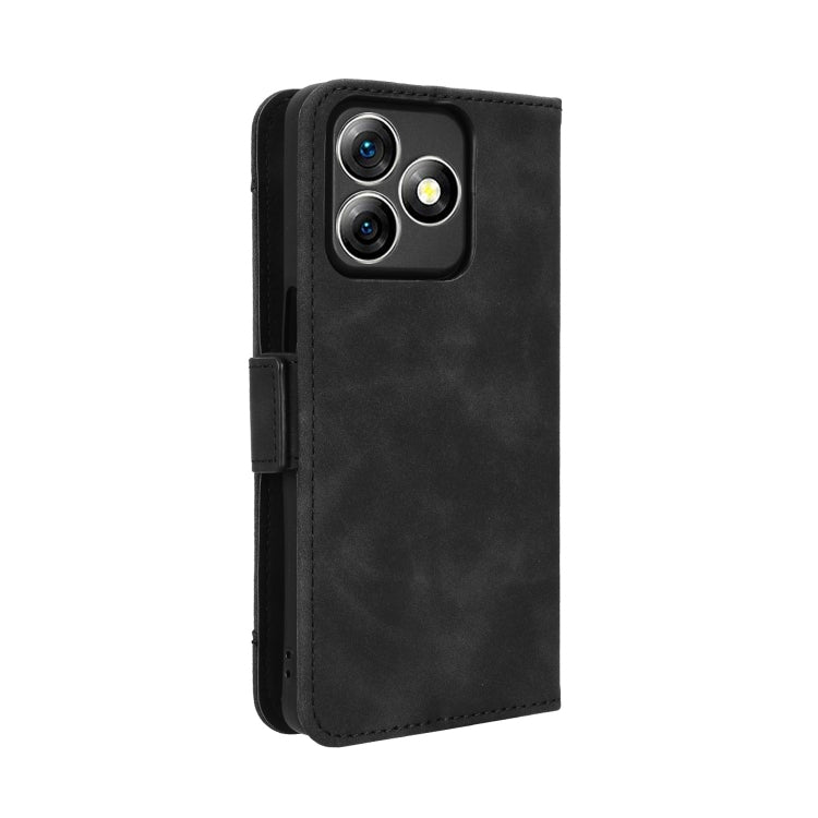 For Ulefone Note 18 Ultra Skin Feel Calf Texture Card Slots Leather Phone Case(Black) by buy2fix