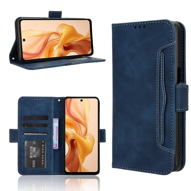 For Ulefone Note 18 Ultra Skin Feel Calf Texture Card Slots Leather Phone Case(Blue) by buy2fix
