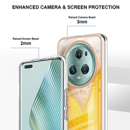 For Honor Magic 5 Pro Electroplating Marble Dual-side IMD Phone Case(Draft Beer) - Honor Cases by buy2fix | Online Shopping UK | buy2fix