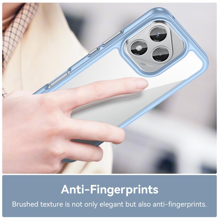 EDA007398813B_4.jpg@dc022c98409865cf802ad27bd3c219f5