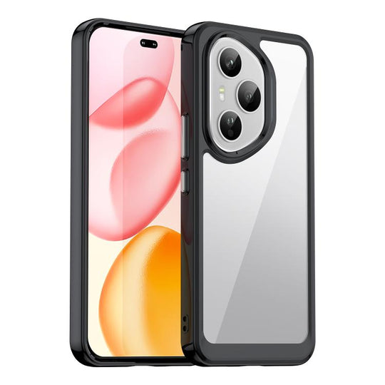 For Honor 400 Pro 5G Global 160.8mm Colorful Series Acrylic Hybrid TPU Phone Case(Black)