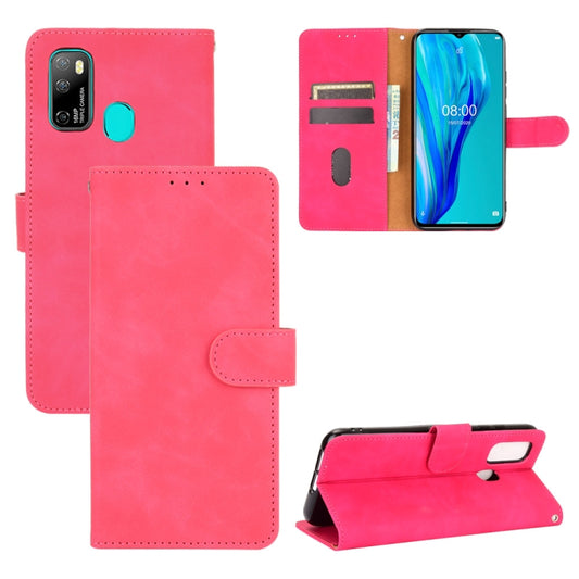 For Ulefone Note 9P Solid Color Skin Feel Magnetic Buckle Horizontal Flip Calf Texture PU Leather Case with Holder & Card Slots & Wallet(Rose Red) by buy2fix