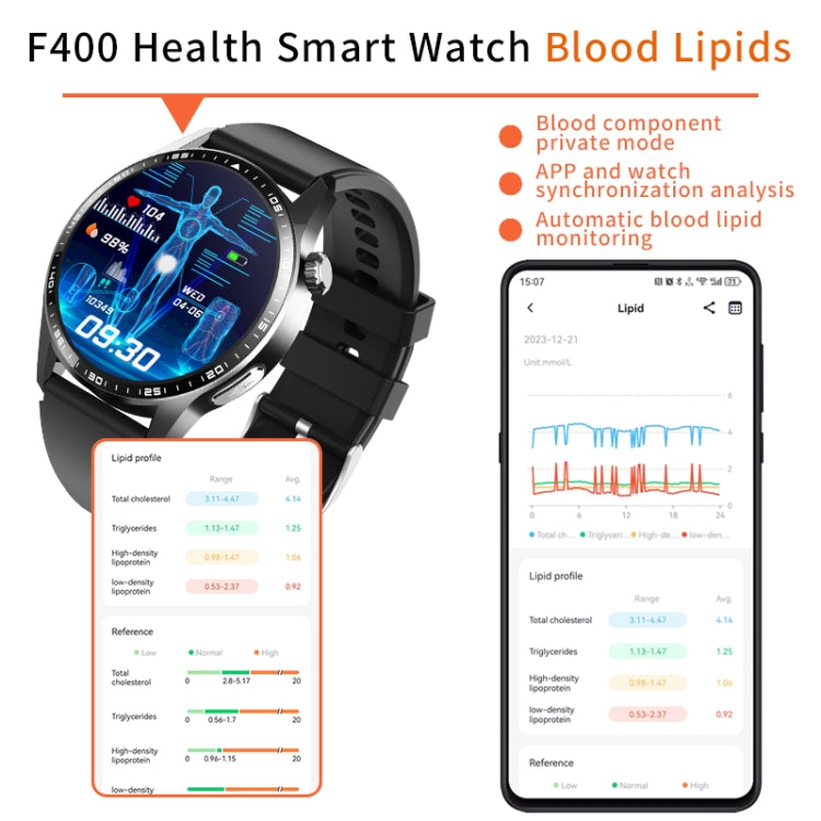F400 1.55 Inch Screen Smart Watch Support ECG/ Blood Oxygen / Blood Sugar / 150+ Sports Mode, Color: Black Brown Leather by buy2fix