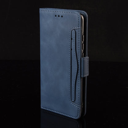 For ZTE Axon 20 5G / Axon 20 4G Wallet Style Skin Feel Calf Pattern Leather Case with Separate Card Slots(Blue) - ZTE Cases by buy2fix | Online Shopping UK | buy2fix
