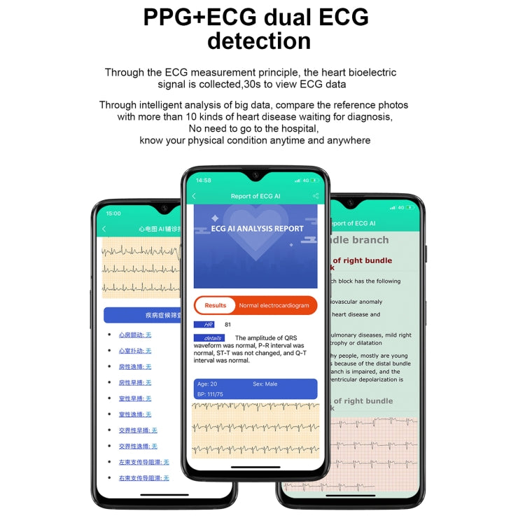 E86 1.7 inch TFT Color Screen IP68 Waterproof Smart Watch, Support Blood Oxygen Monitoring / Body Temperature Monitoring / AI Medical Diagnosis, Style: Steel Strap(Black) by buy2fix