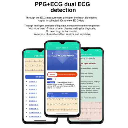 E86 1.7 inch TFT Color Screen IP68 Waterproof Smart Watch, Support Blood Oxygen Monitoring / Body Temperature Monitoring / AI Medical Diagnosis, Style: Steel Strap(Black) by buy2fix