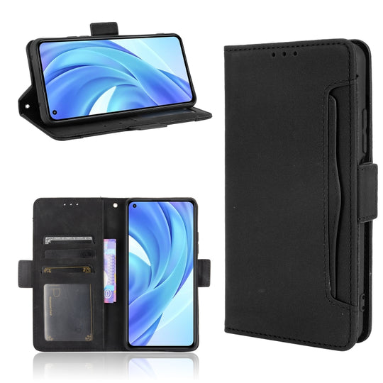 For Xiaomi Mi 11 Lite 4G / Mi 11 Lite 5G Skin Feel Calf Pattern Horizontal Flip Leather Case with Holder & Card Slots & Photo Frame(Black)