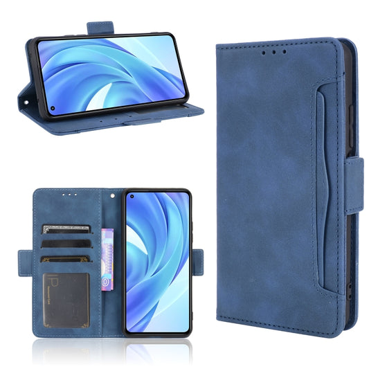 For Xiaomi Mi 11 Lite 4G / Mi 11 Lite 5G Skin Feel Calf Pattern Horizontal Flip Leather Case with Holder & Card Slots & Photo Frame(Blue) - Xiaomi Cases by buy2fix | Online Shopping UK | buy2fix