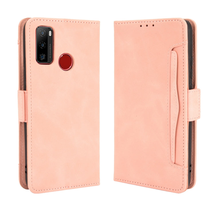 For Ulefone Note 10 Skin Feel Calf Pattern Horizontal Flip Leather Case with Holder & Card Slots & Photo Frame(Pink) - Ulefone Cases by buy2fix | Online Shopping UK | buy2fix