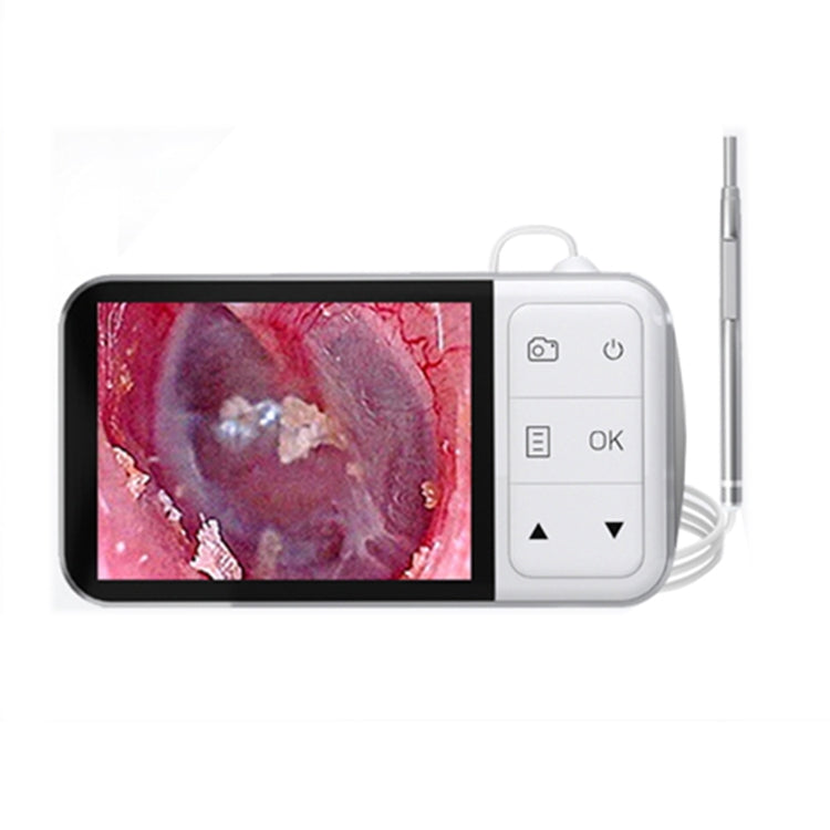 C02 Visible Ear Spoon with 4.5 inch Sreen by buy2fix