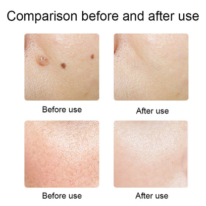 FY-106 Portable Mole and Freckle Removal Pen Household Laser Beauty Equipment(Rose Gold) - Beauty Instrument by buy2fix | Online Shopping UK | buy2fix